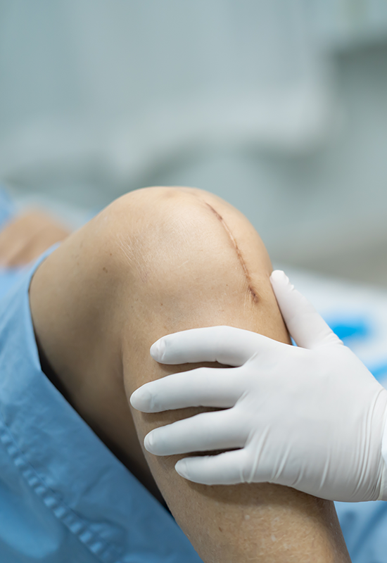 knee-surgery-image
